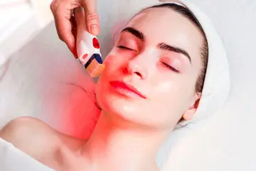 Microneedling