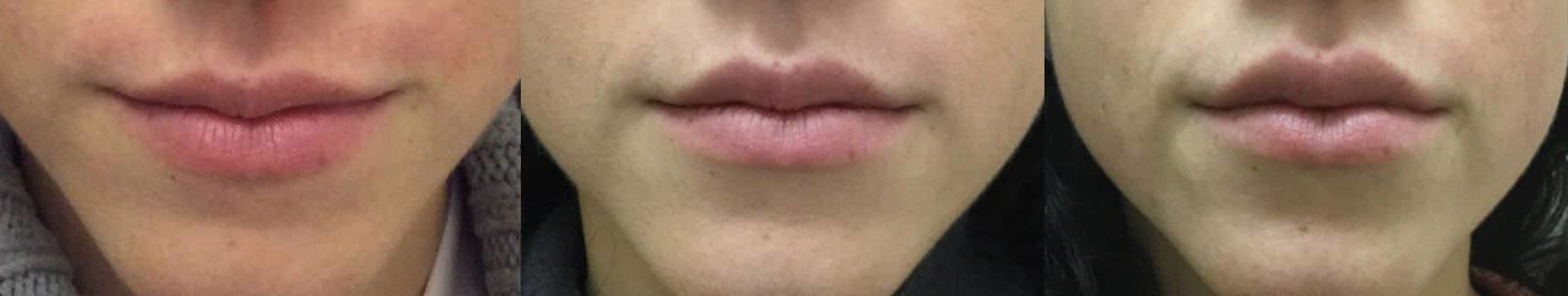 Lips 2 E1597430620786