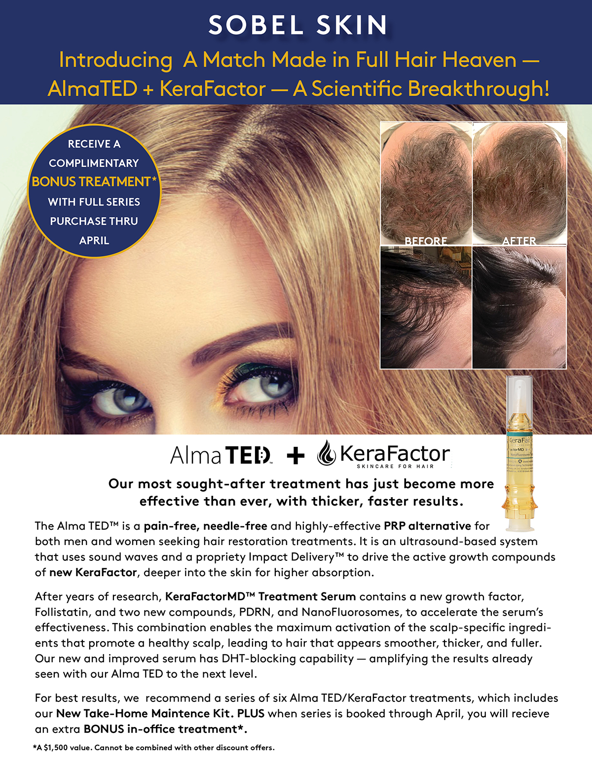 APRIL 2026 AlmaTED KERA 1